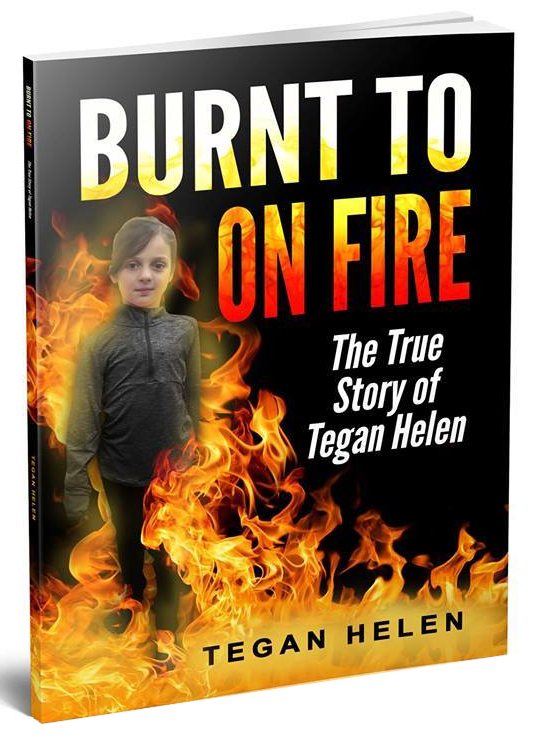Book - Burnt to on Fire by Tegan Helen